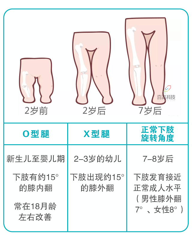 寶寶身長腿短，長大會是矮個子嗎？_03.gif