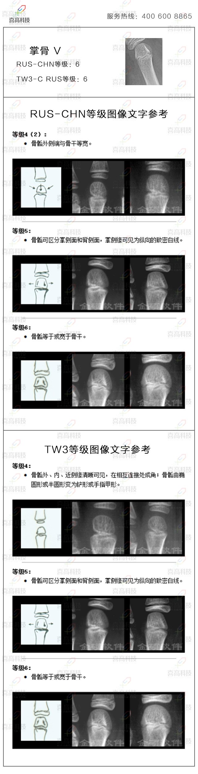 21-zhang5.jpg